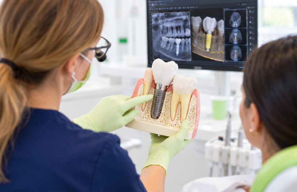 Beratung zu Zahnimplantaten mit Implantatmodell und digitaler Planung